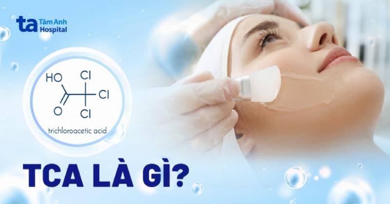 Bảng so sánh ưu nhược điểm của các phương pháp trị thâm mụn chuyên sâu (peel, laser, lăn kim)